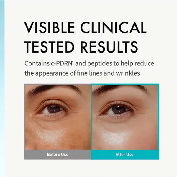 Rejuran Advanced Active Night Repair Eye Cream 15g