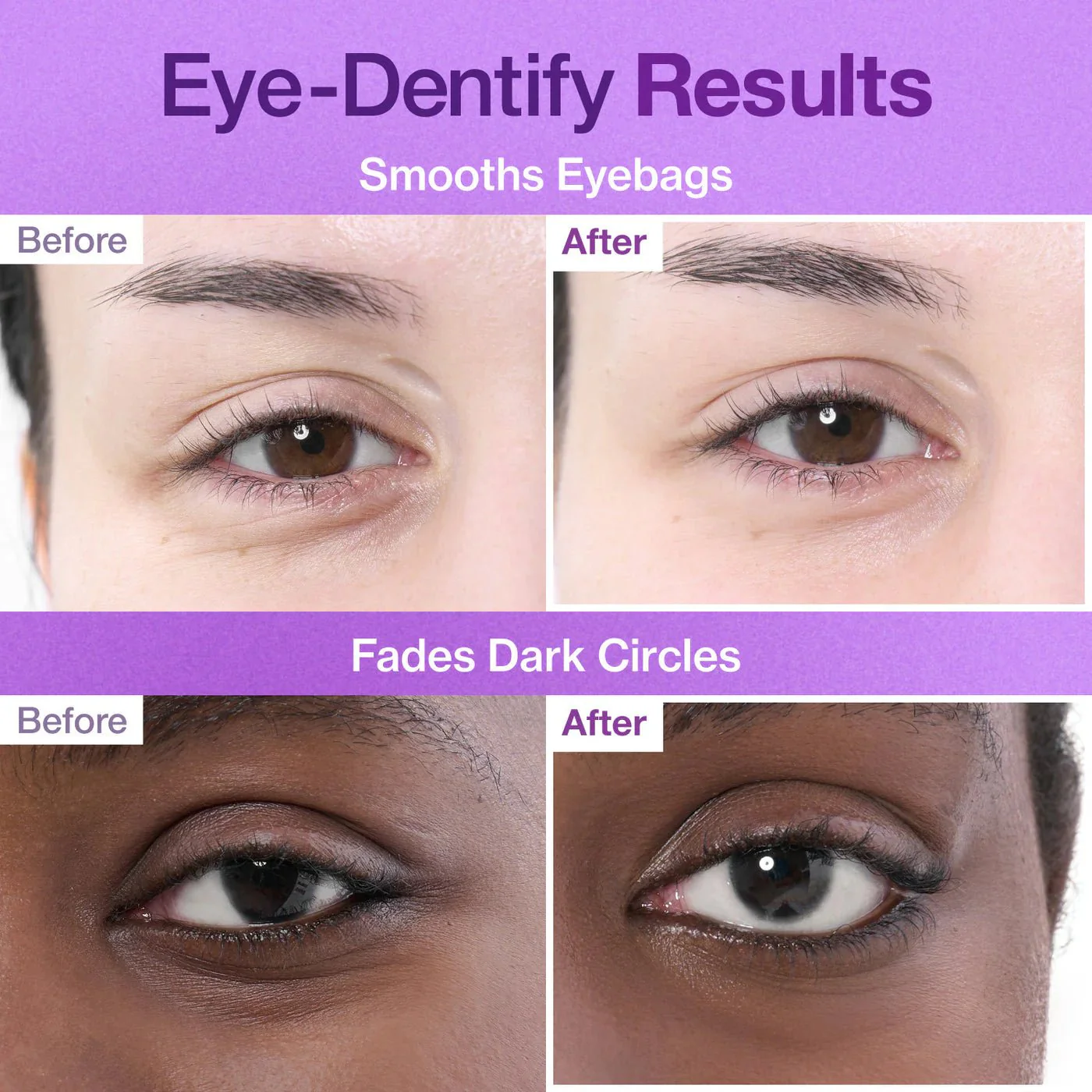 Vanusevastased Liftingupadjad numbuzin No.9 NAD+ Collagen Under Eye Patches 10tk - Image 4