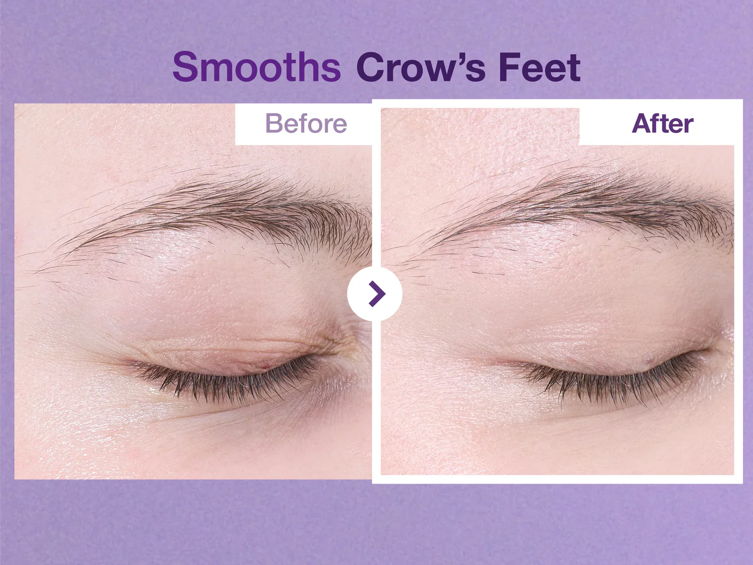 numbuzin No.9 NAD+ Retinol Volumetox Eye Cream 10ml